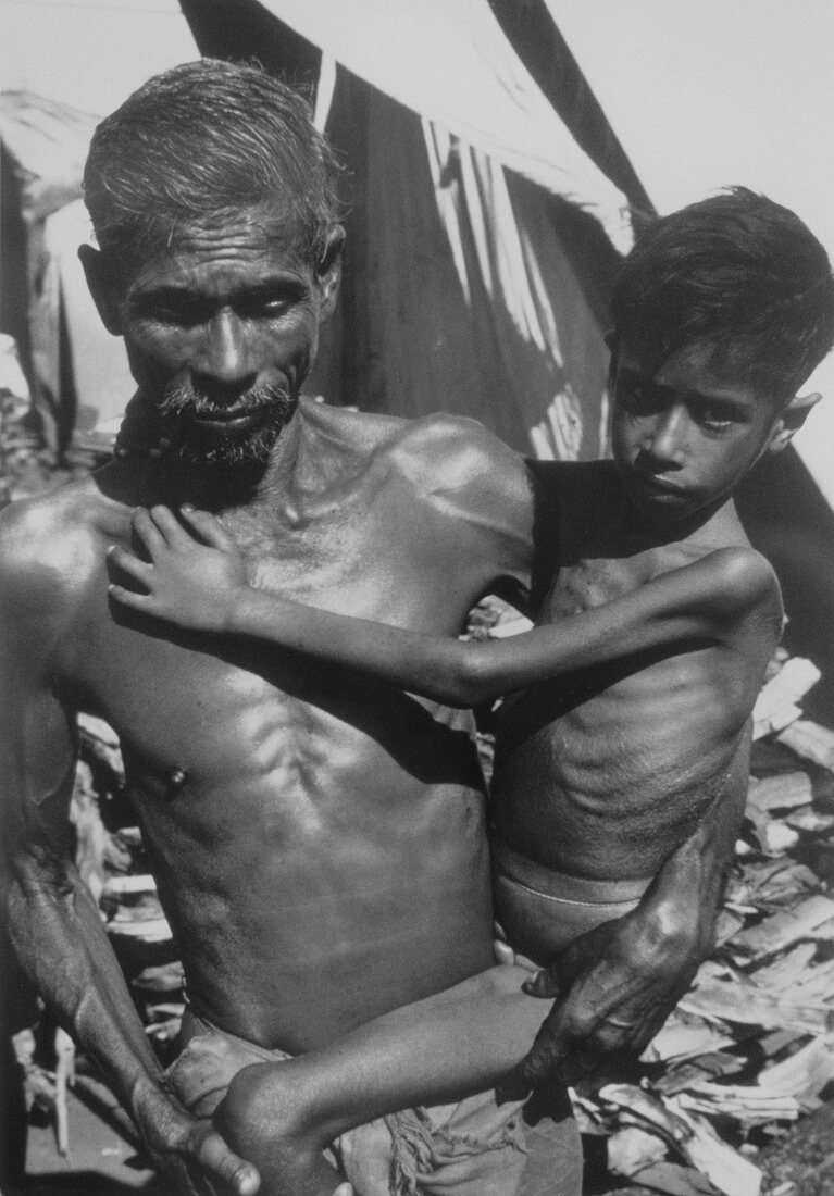 Malnourished Indian man carries his emaciated son
