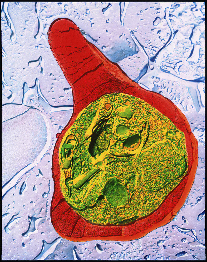 TEM of blood cell with malaria