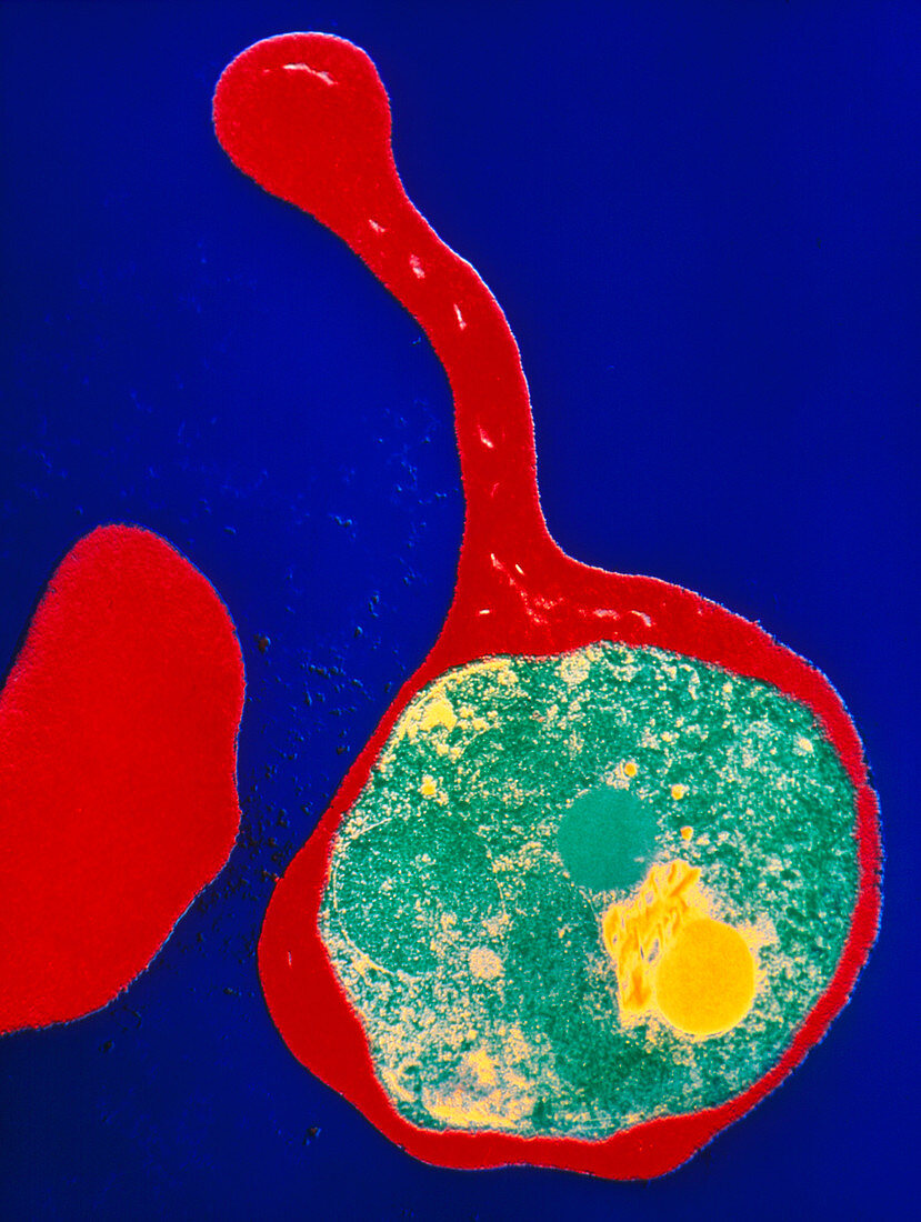 Coloured TEM of a red blood cell with malaria