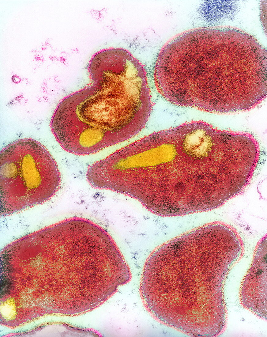 Malaria parasites,TEM