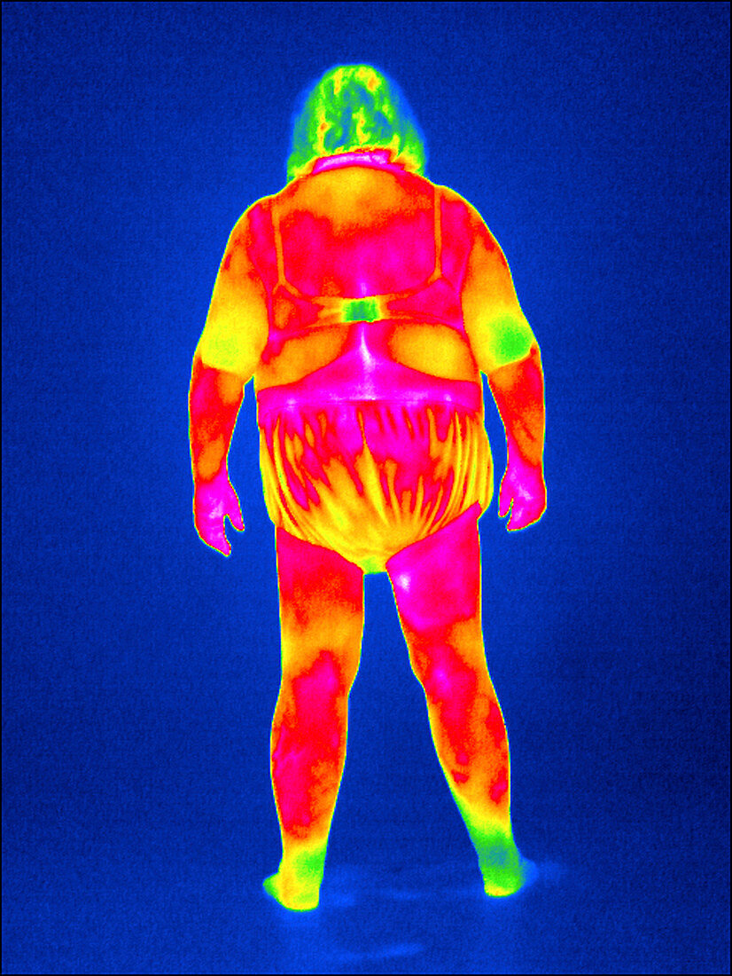 Obese woman,thermogram