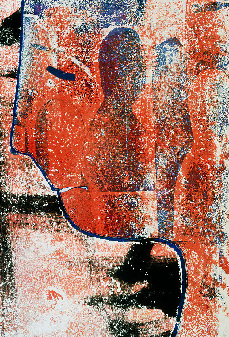 Abstract art depicting a sufferer of schizophrenia