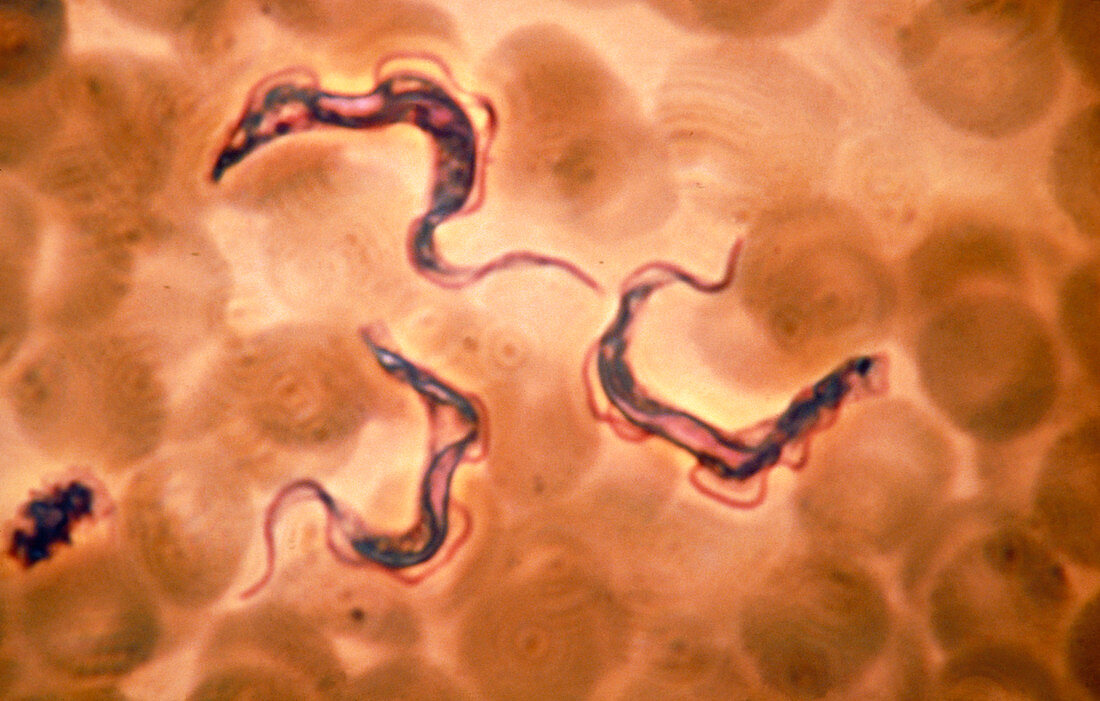 LM of Trypanosoma gambiense,sleeping sickness bug