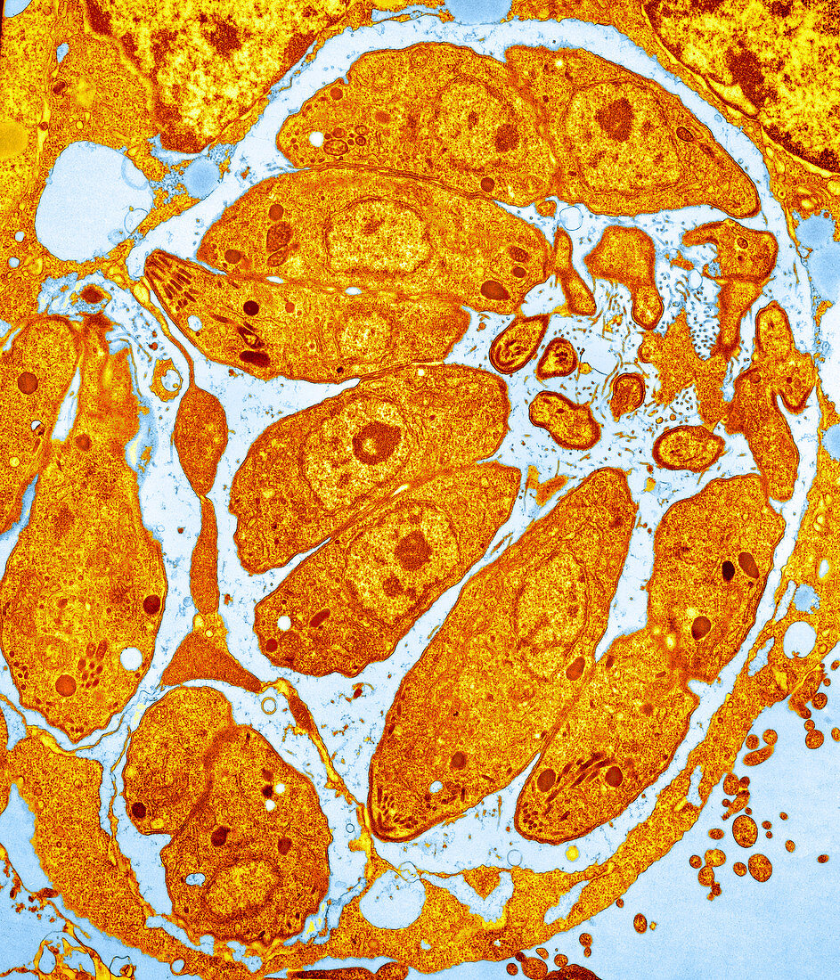 Toxoplasma parasites in a cell,TEM