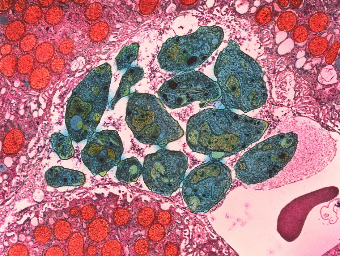 TEM of toxoplasma gondii parasites