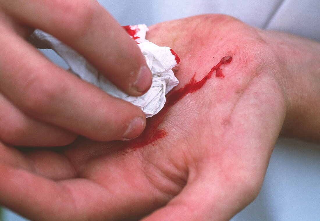 Cut hand