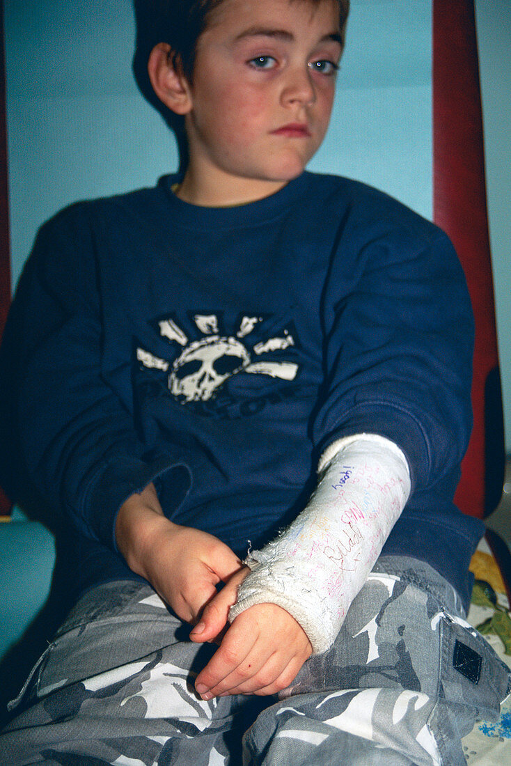 Broken wrist