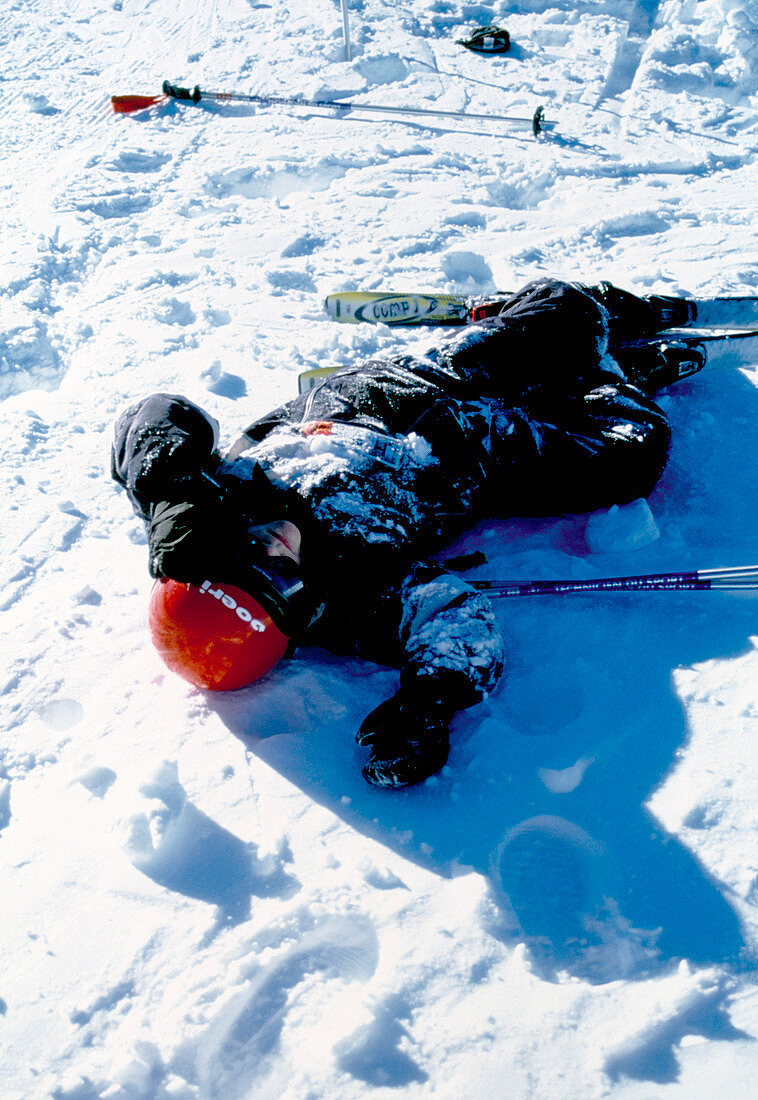 Skiing accident