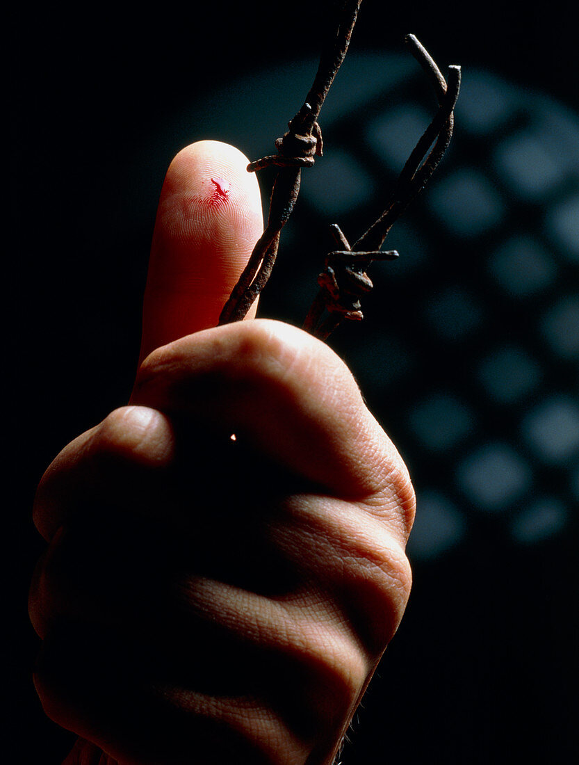 Finger pricked on barbed wire: cause of tetanus