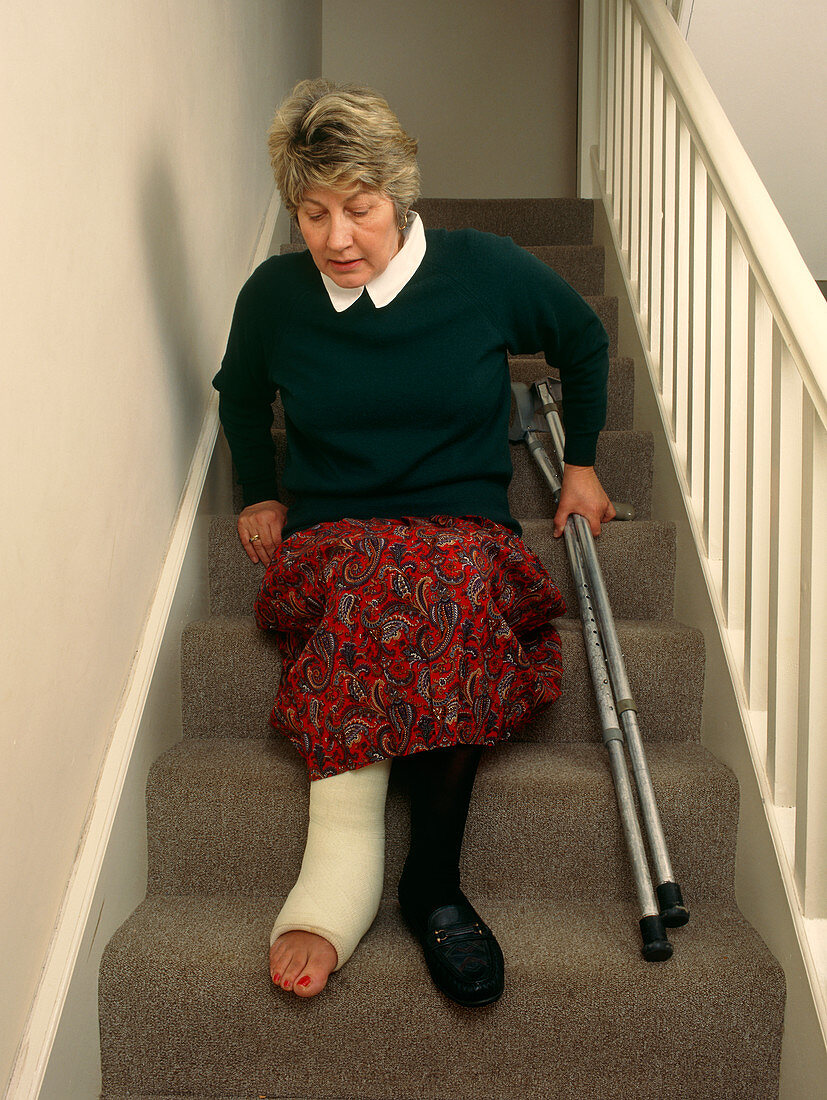 Woman with broken leg descends staircase