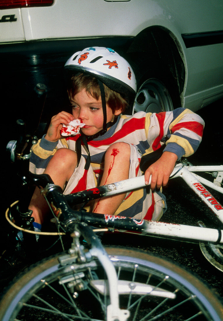 Boy with nosebleed & grazed knee after bike fall