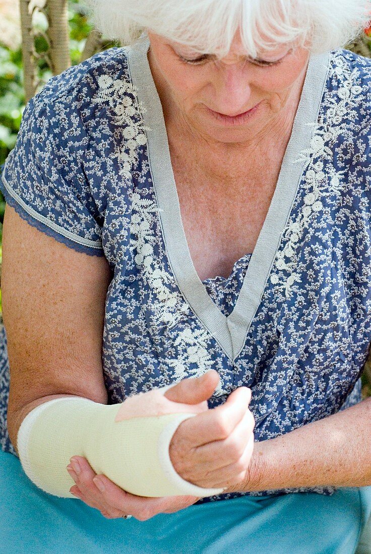 Senior lady with a broken arm