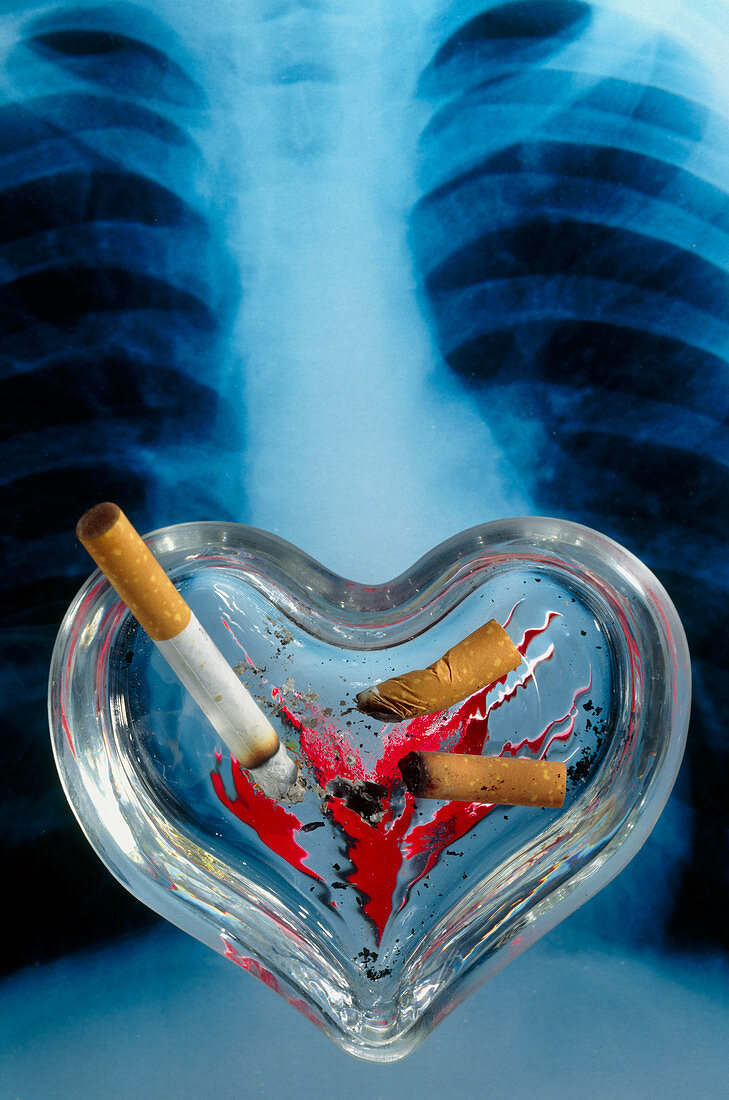 Heart-shaped ash tray,cigarettes,lung X-ray