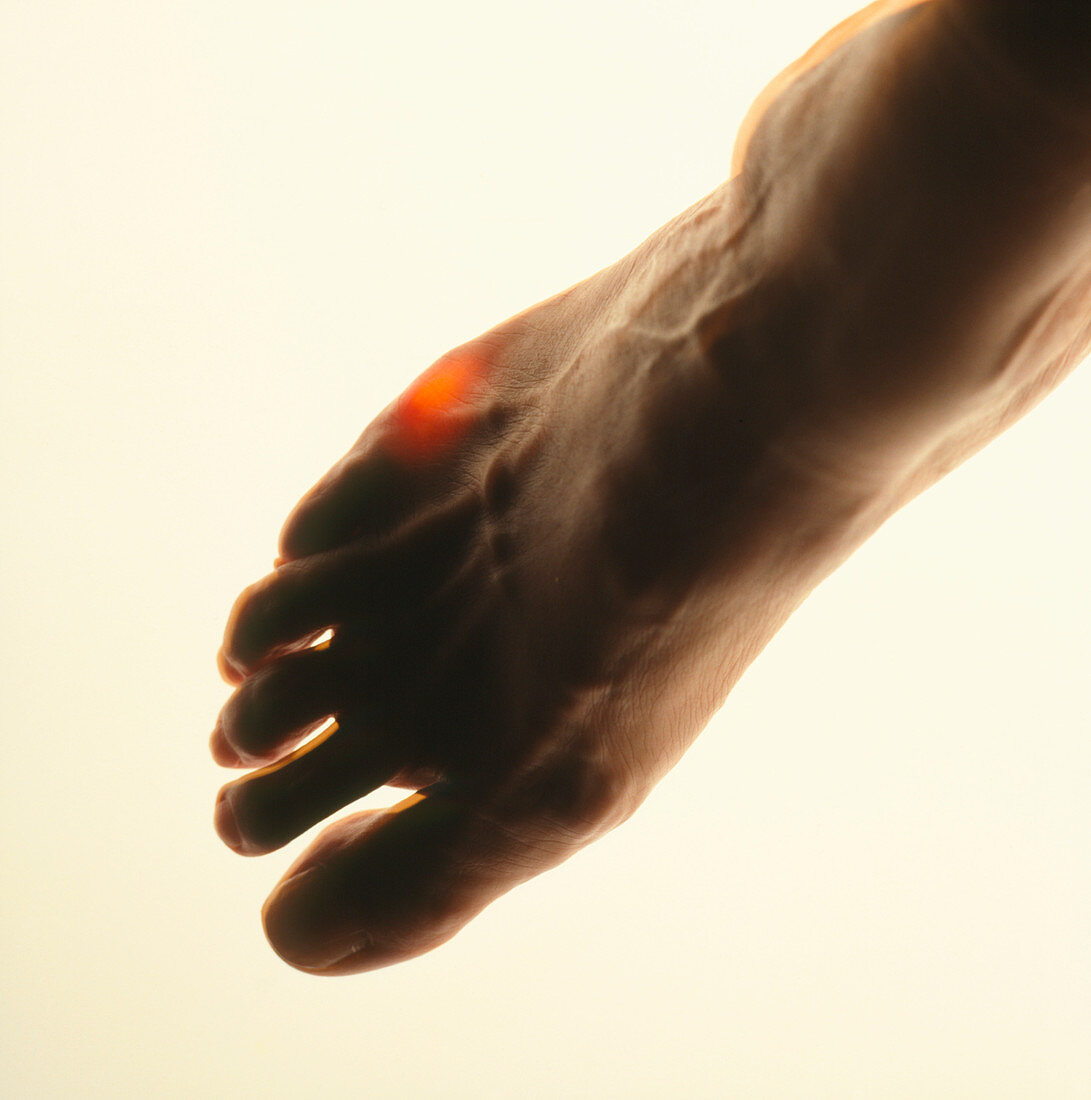 Abstract image of foot depicting pain in a toe