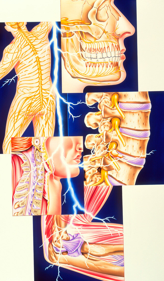 Artwork showing common sites of pain