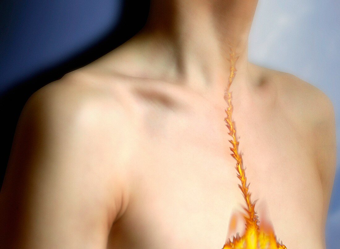 Heartburn,conceptual image