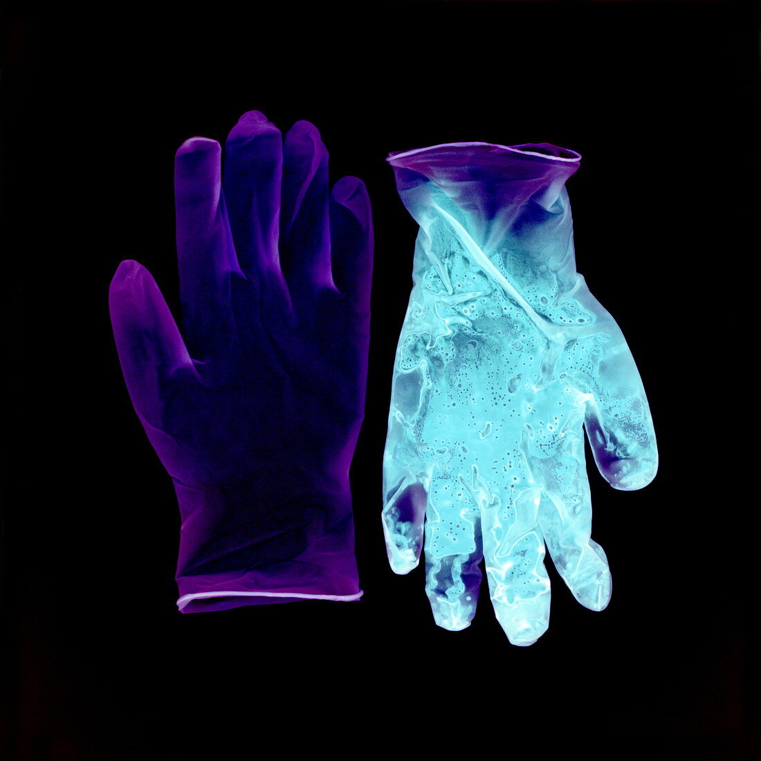Gloves pre- and post-op,negative image