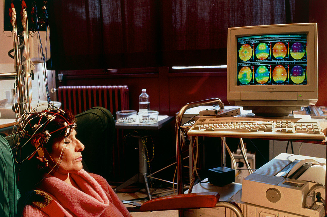 EEG studies of Alzheimer's disease