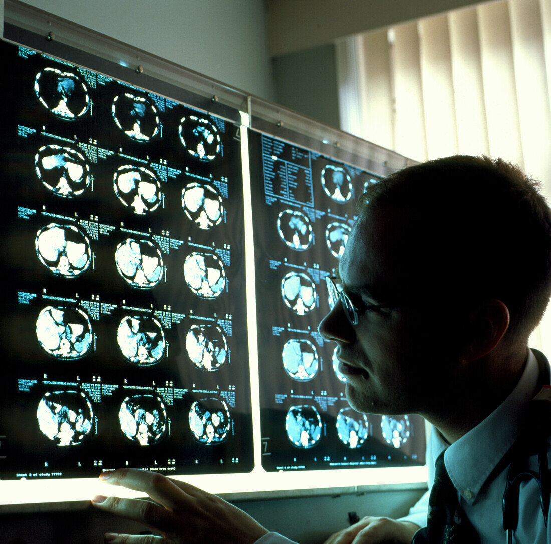 Male doctor viewing abdominal CT scans