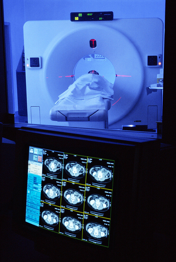 CT scanning