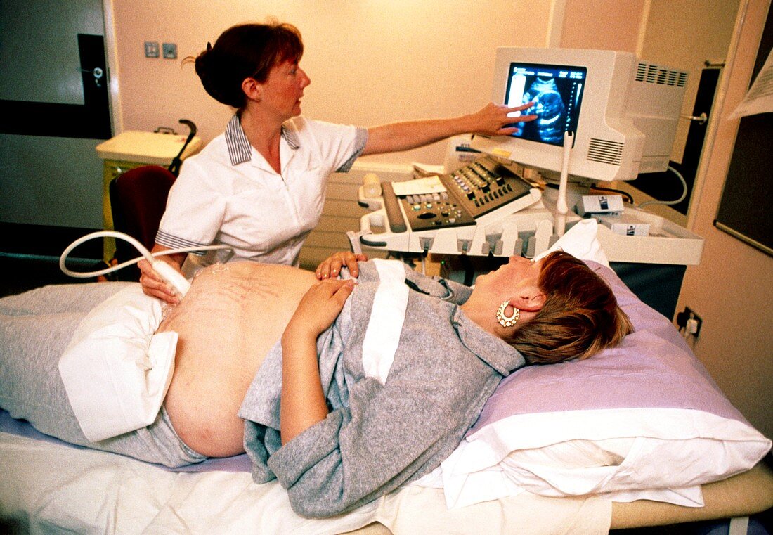 Ultrasound scan