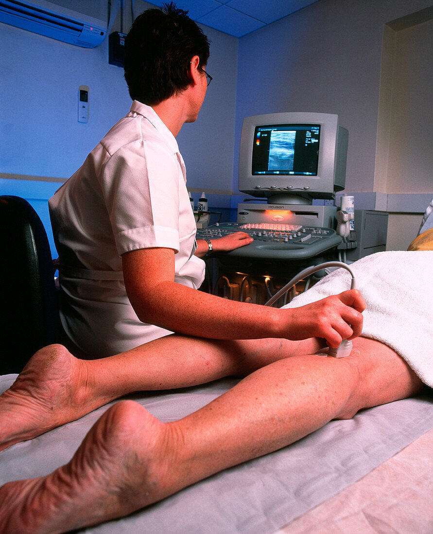 Doppler ultrasound examination of a leg