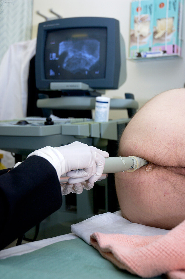 Ultrasound biopsy of prostate