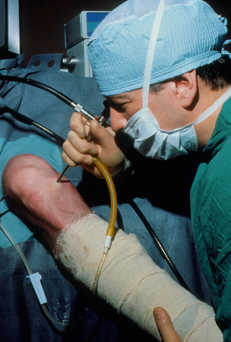 Use of arthroscope to examine patient's knee joint