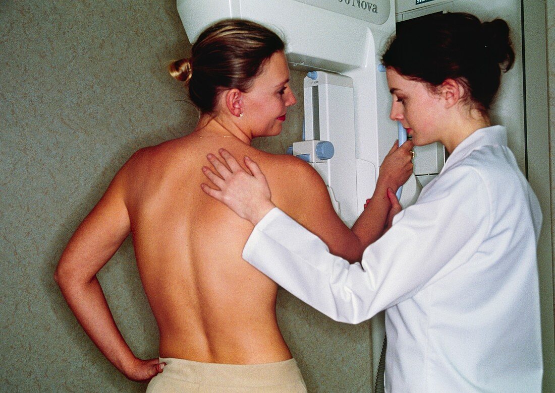 Mammography