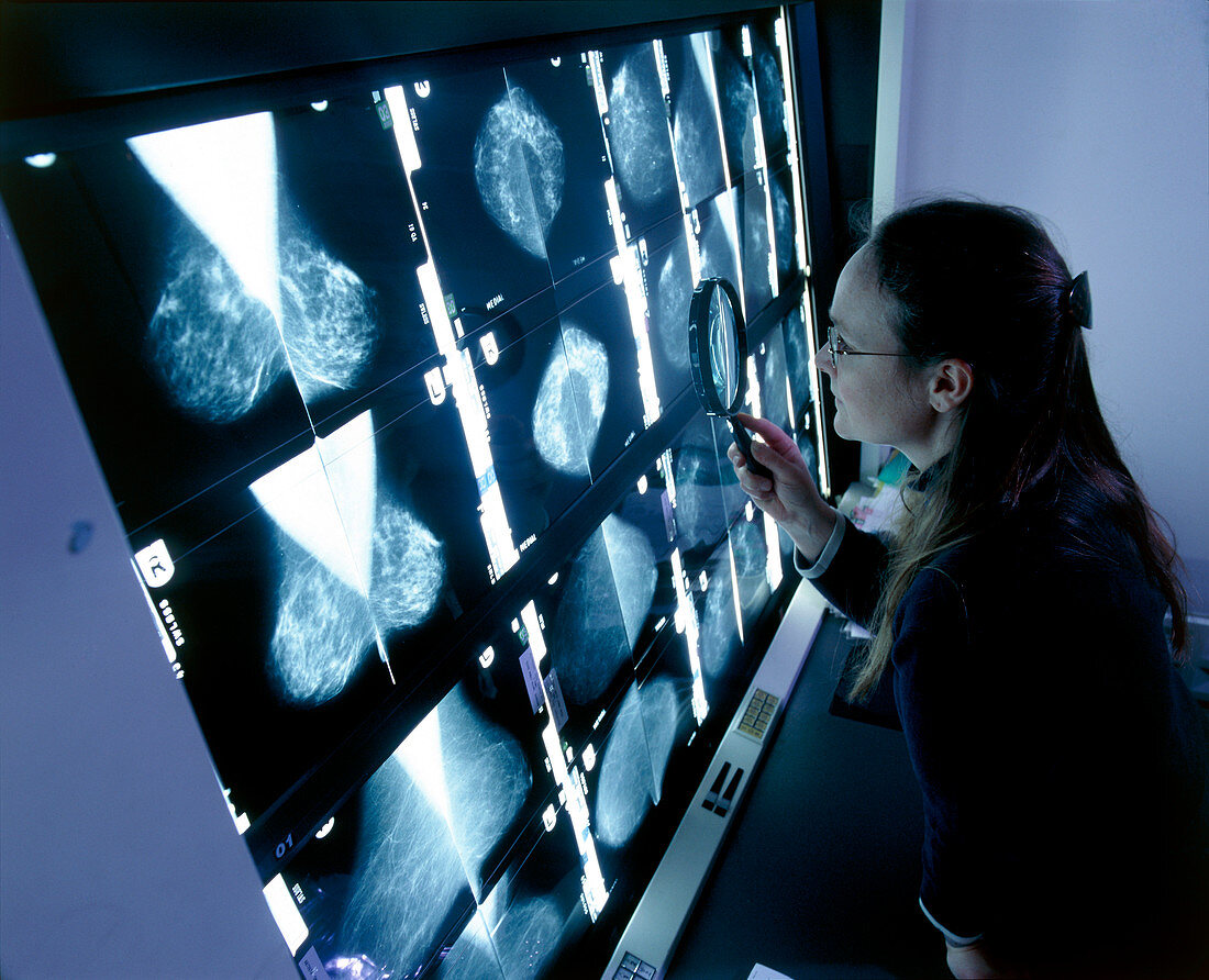 Radiologist studying mammograms