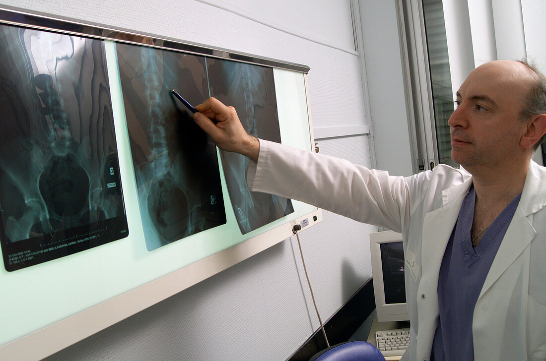 Radiologist with kidney stone X-rays