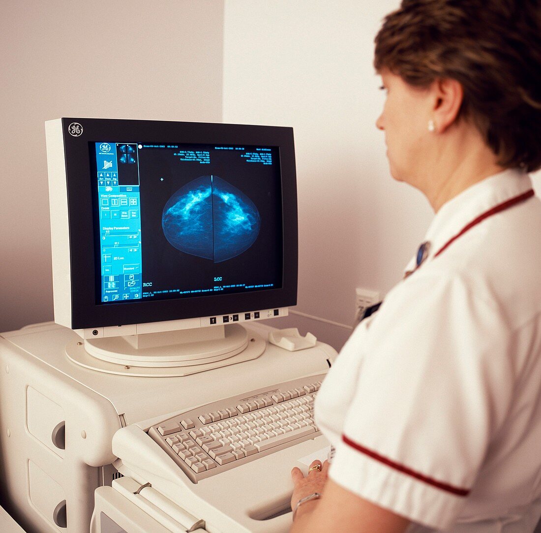 Breast X-rays