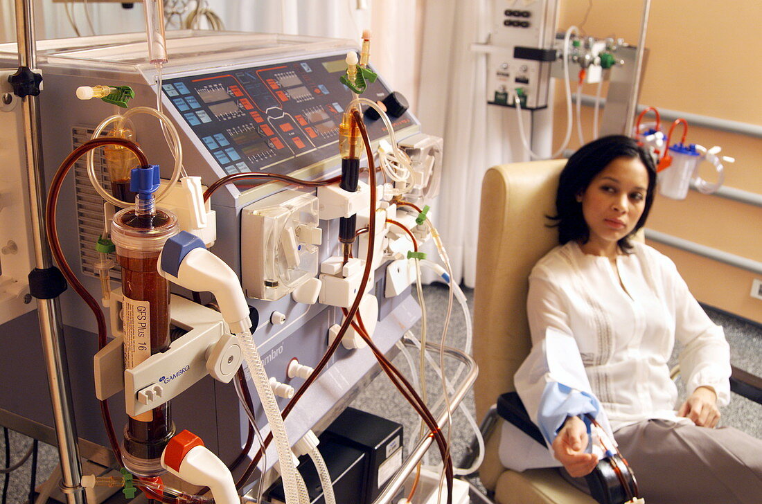 Kidney dialysis