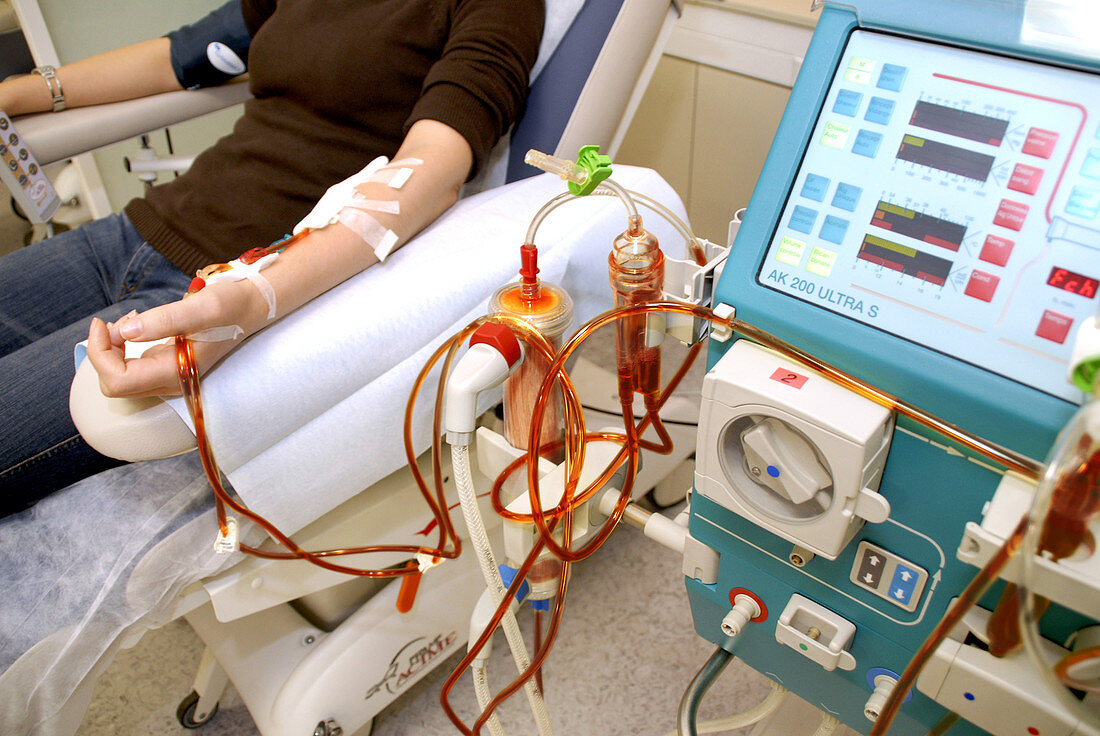 Dialysis machine