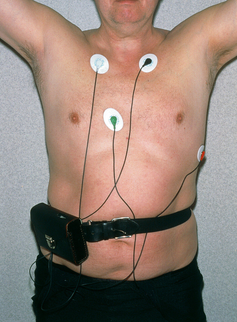 Patient wearing Holter monitor,a portable ECG