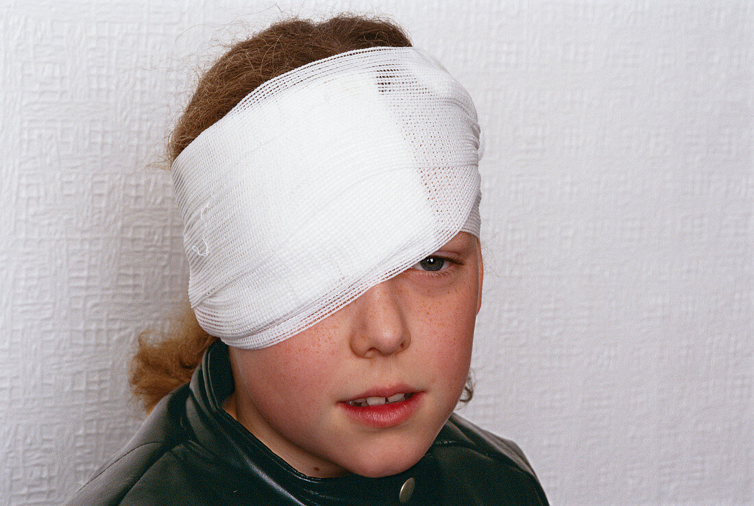 Bandaged eye