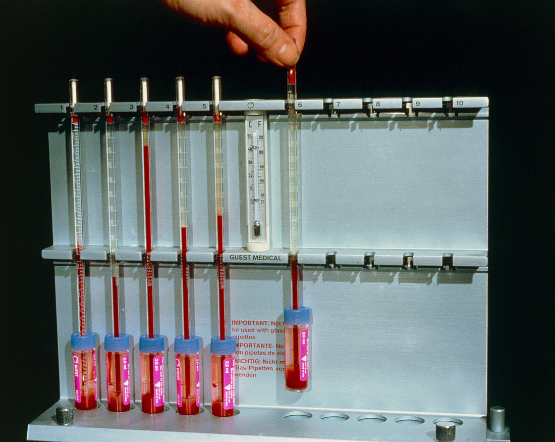 Measurement of ESR of blood