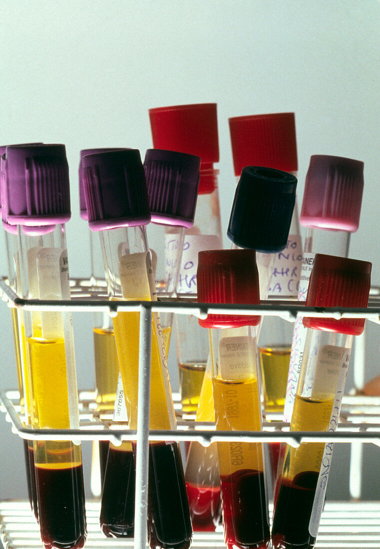 Centrifuged blood samples in test tubes
