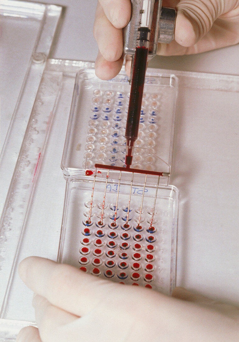 ELISA blood test for antibodies to disease