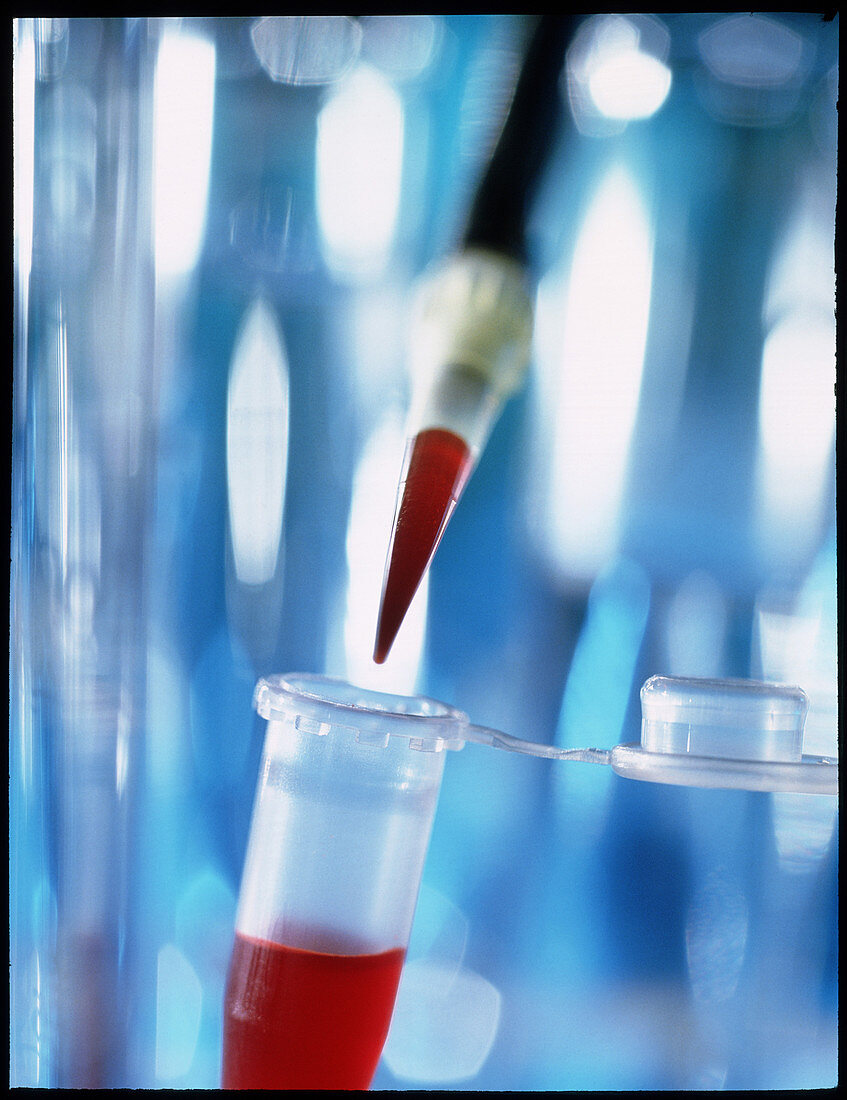 Blood sample being pipetted into a microtube