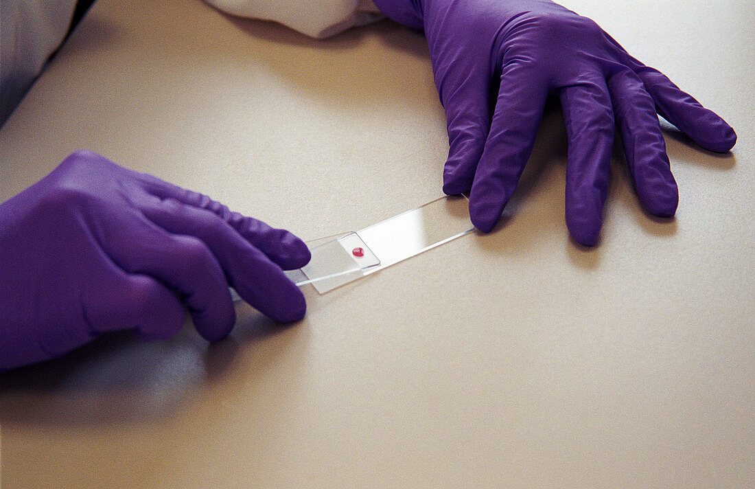 Preparing blood smear