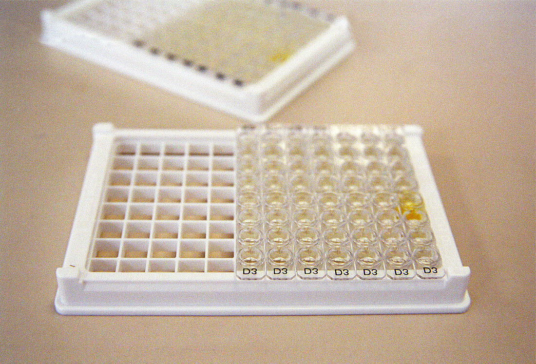 ELISA test plate