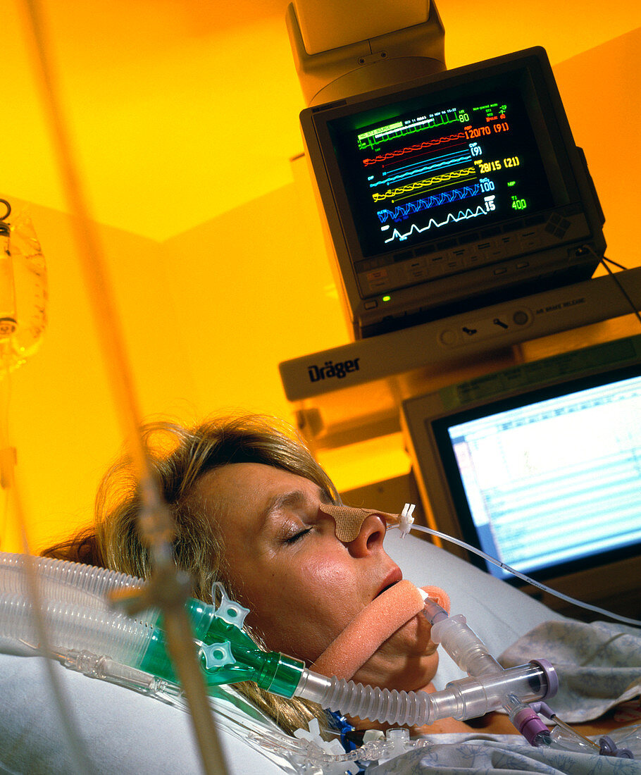 Intensive care monitoring of a woman