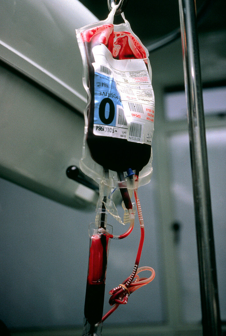 Bag of blood ready for transfusion