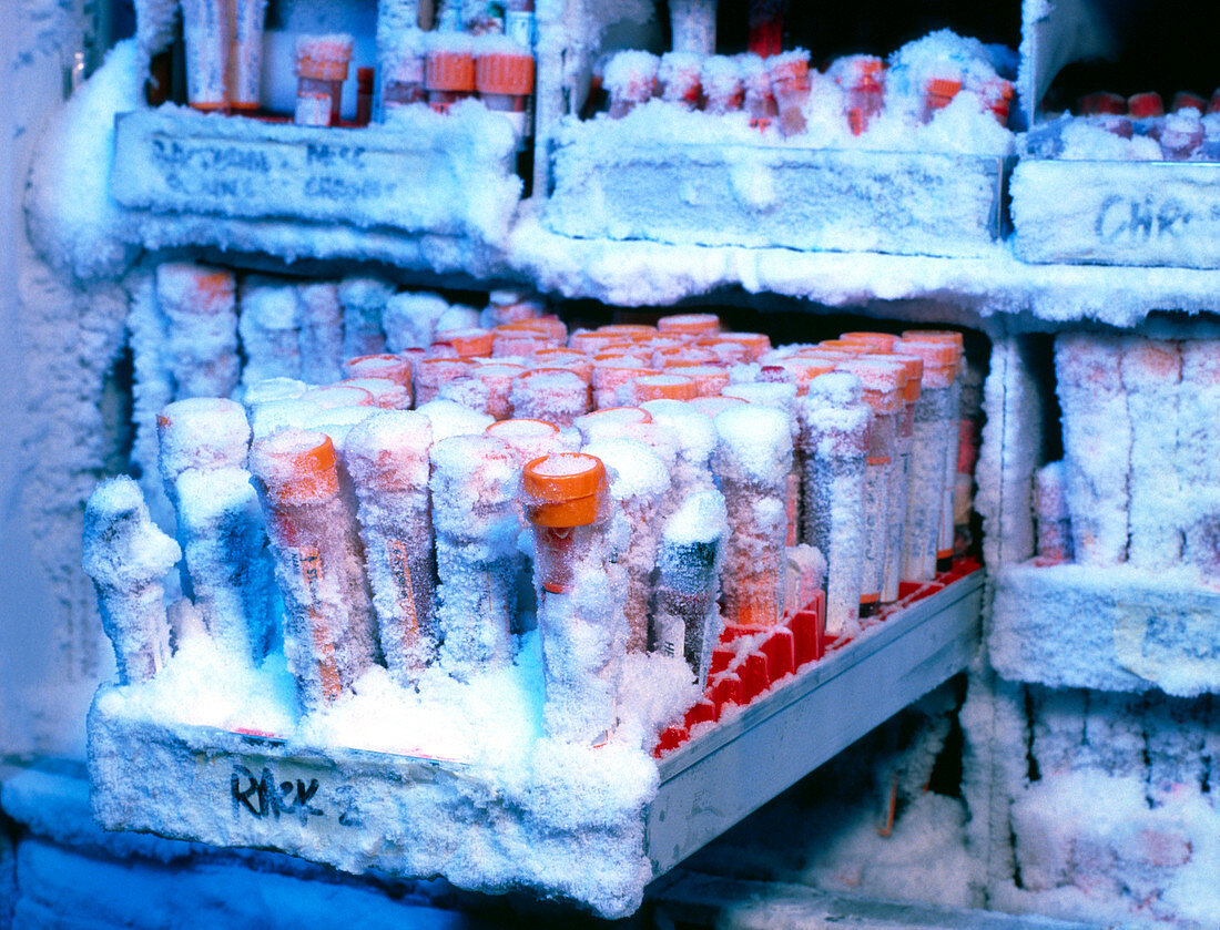Blood samples cryogenic storage freezer