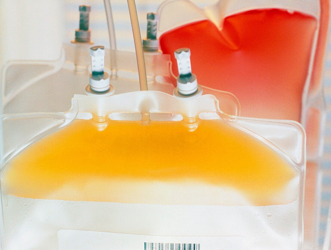 Blood bag containing platelets (yellow)