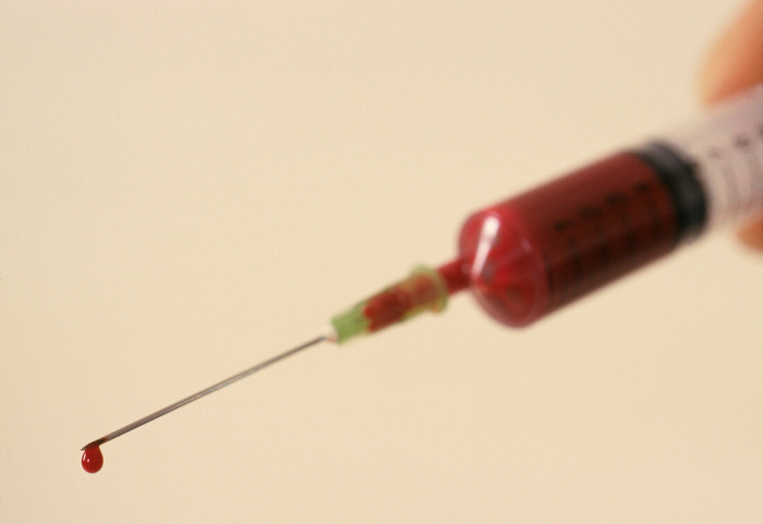 Syringe containing a venous blood sample