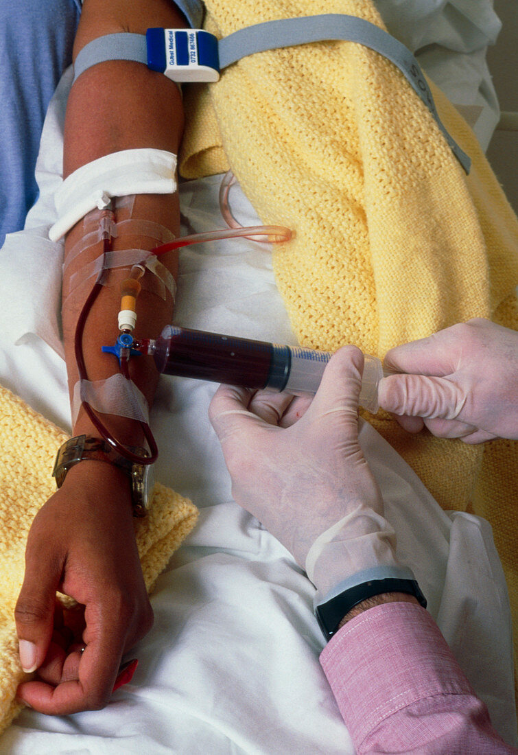 Sickle cell patient has blood transfusion in arm
