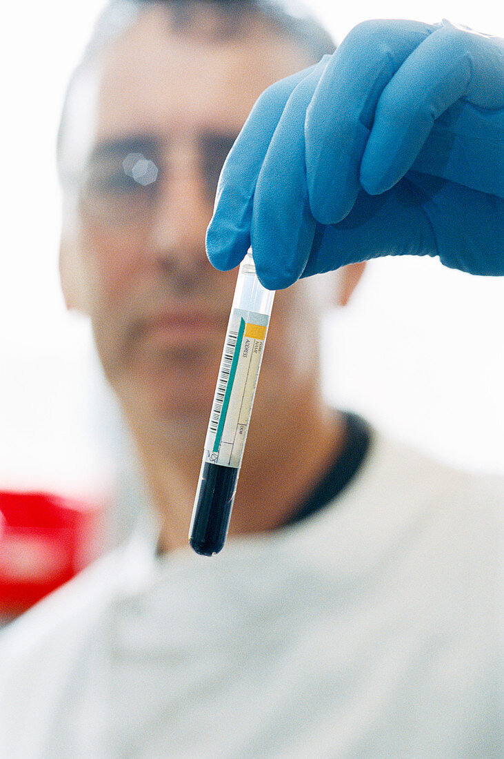 Pathologist with blood sample