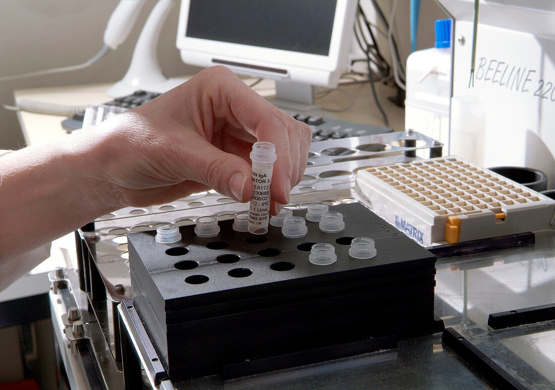 Semi-automated ELISA blood test